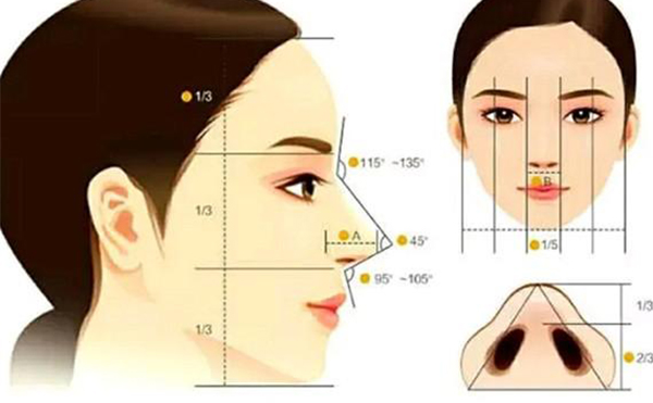 假體隆鼻恢復期要多長時間？假體隆鼻不滿意還能做注射隆鼻改善嗎？