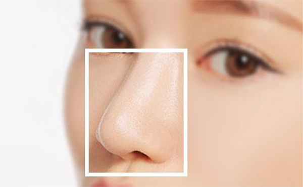 假體隆鼻后鼻子會(huì)發(fā)生變形嗎?這與什么因素有關(guān)?