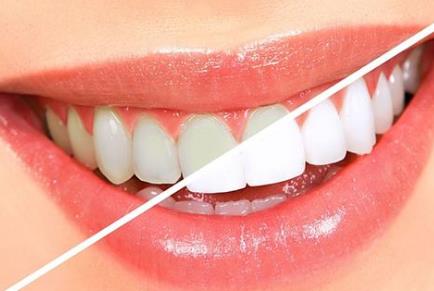 做牙冠多少錢一顆？