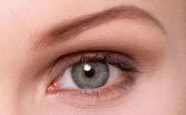 歐式雙眼皮是什么樣的？