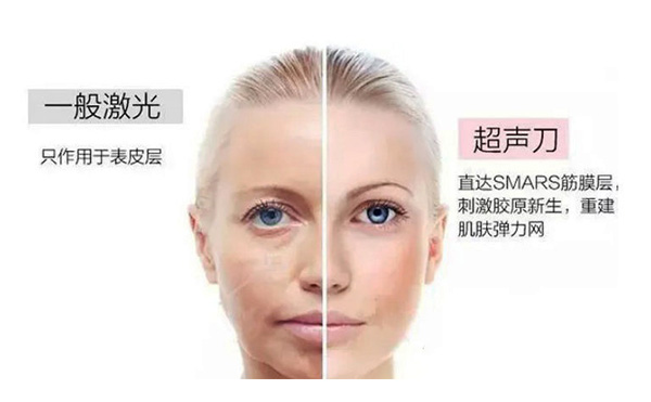 超聲刀有什么優(yōu)勢(shì)？