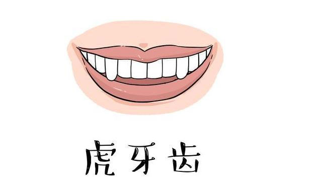 虎牙矯正需要多久？