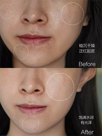 九江協(xié)和光子嫩膚--素顏也扛打的秘密