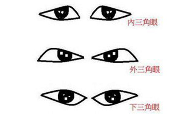 不同程度的三角眼如何改善?效果怎么樣?