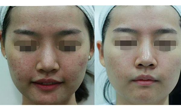 白瓷娃娃是怎么做的?有什么優(yōu)勢?