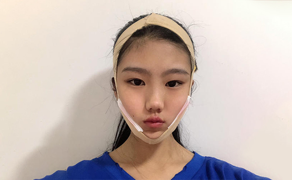 想要確保下頜角整形手術(shù)順利和術(shù)后效果，術(shù)前應(yīng)該做哪些攻略?