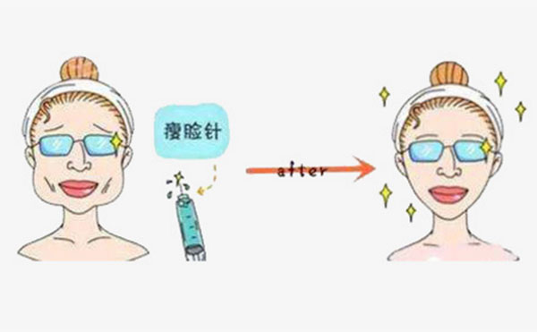 是否會對瘦臉針產(chǎn)生依賴?