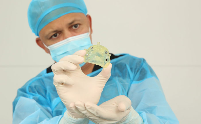 貴金屬烤瓷牙有哪些？貴金屬烤瓷牙的種類