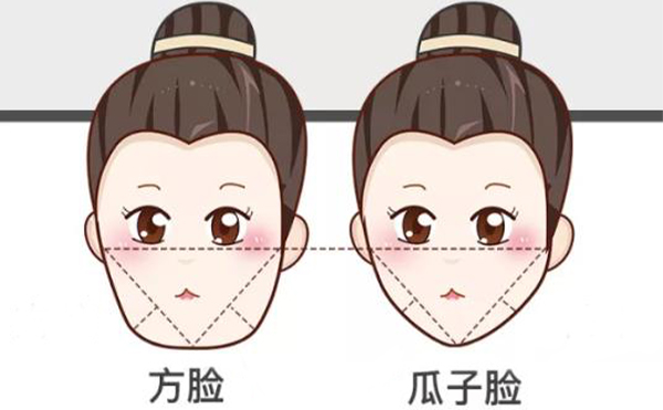 在沈陽伊美爾做下頜角整形有什么優(yōu)勢?