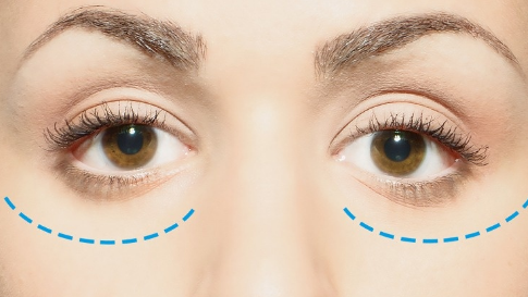 先天性突眼怎么辦？