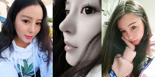 太原時光整形醫(yī)院案例2