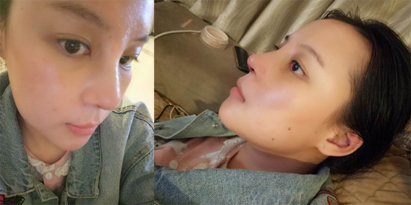 太原時光整形醫(yī)院案例1