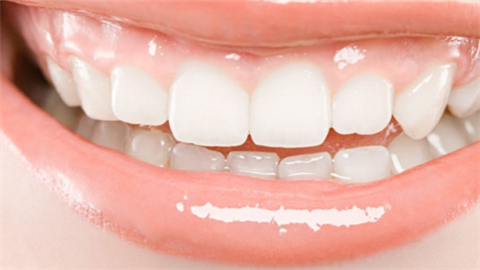 鑲牙和種牙哪種比較好？