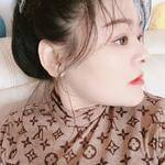 鼻基底整形案例對(duì)比5