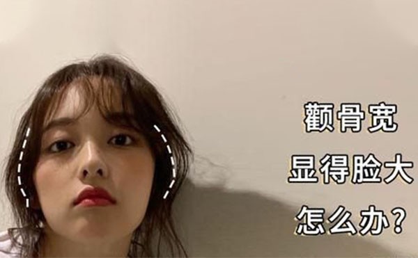 如何改善顴骨過(guò)寬?