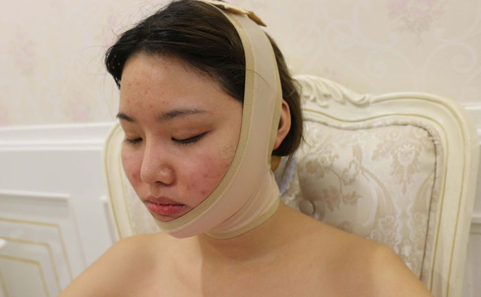 面部吸脂修復(fù)手術(shù)多少錢？面部吸脂會(huì)反彈嗎？