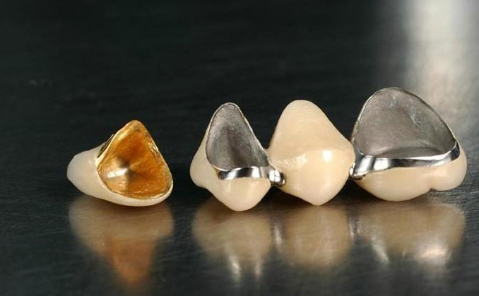 全瓷烤瓷牙多少錢一顆2021？全瓷牙可以用多久？