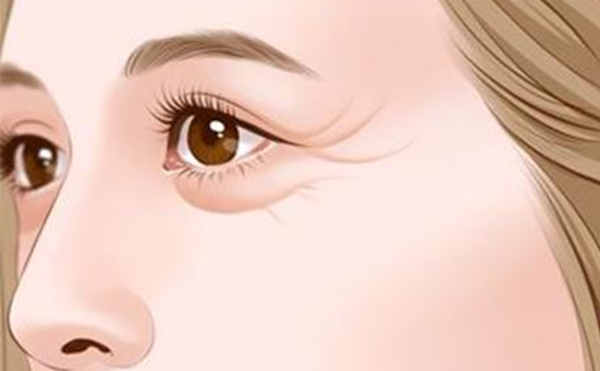 激光去眼袋和手術(shù)去眼袋哪個好?有什么優(yōu)勢?