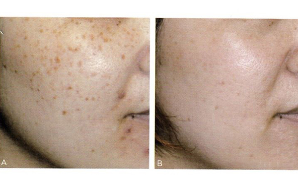 復(fù)合彩光效果怎么樣？