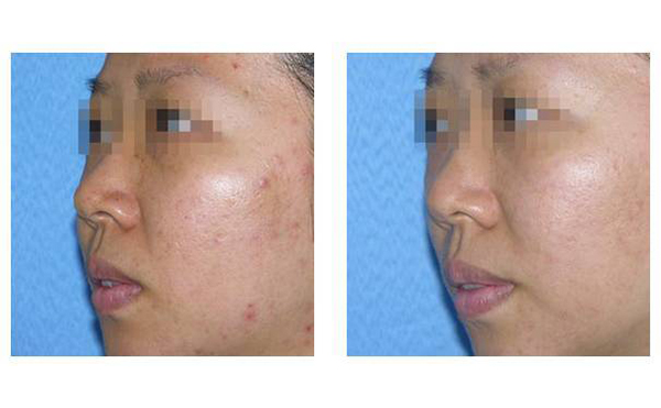 復合彩光多少錢？