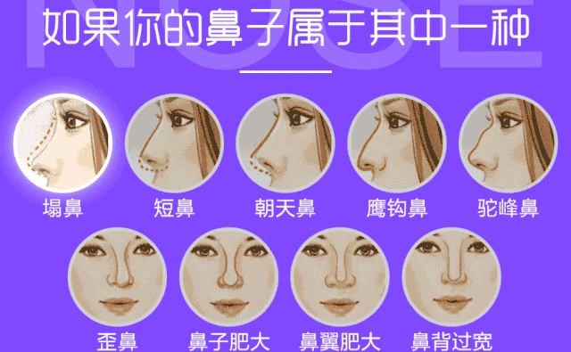 自體脂肪隆鼻可以保持多久?