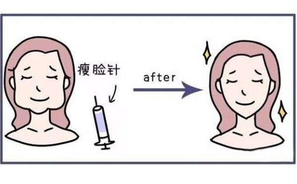瘦臉針有什么功能？