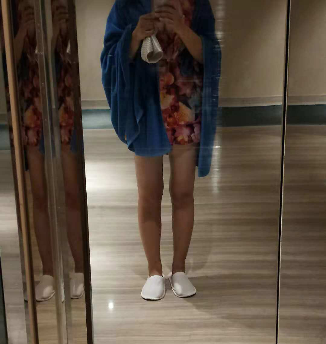 大腿吸脂手術(shù)效果圖4