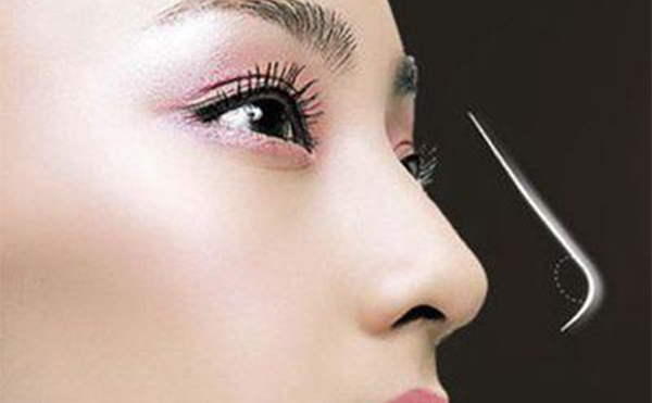 怎樣才能選擇適合的隆鼻方法?