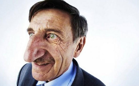 大鼻頭如何變??？鼻頭大怎么改善？