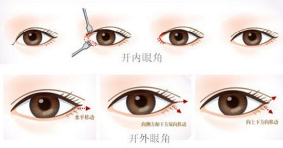 開外眼角