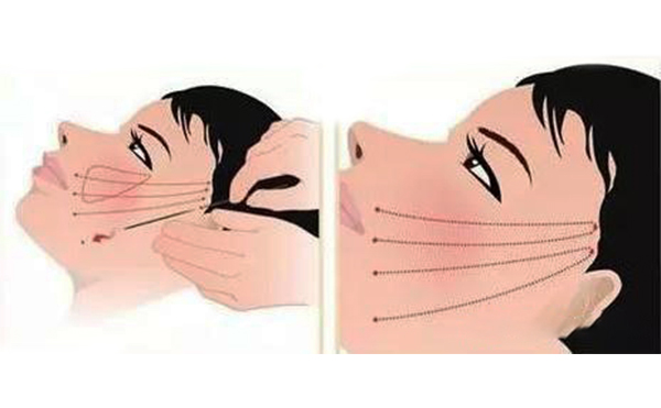 拉皮的原理是什么？