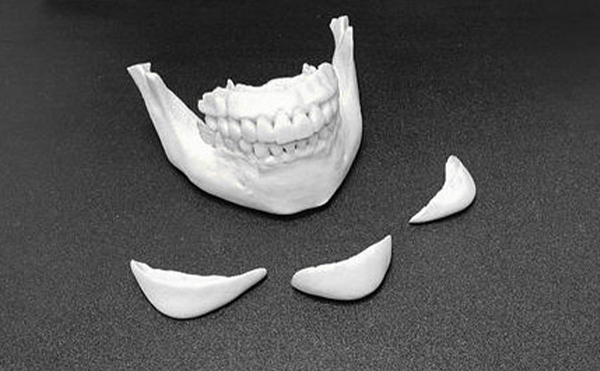 為什么做下巴整形的人越來(lái)越多?假體下巴取出后下巴還能恢復(fù)到術(shù)前的樣子嗎?