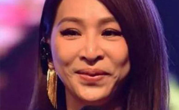 除皺針副作用大嗎？