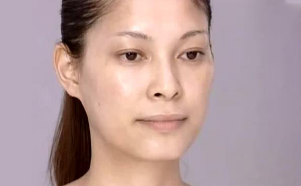 改臉型手術(shù)會(huì)不會(huì)有后遺癥?安全嗎?