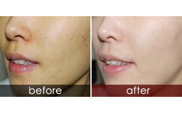 白瓷娃娃適合人群有哪些？