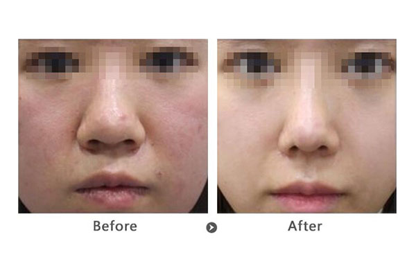 做黑臉娃娃前要注意什么？