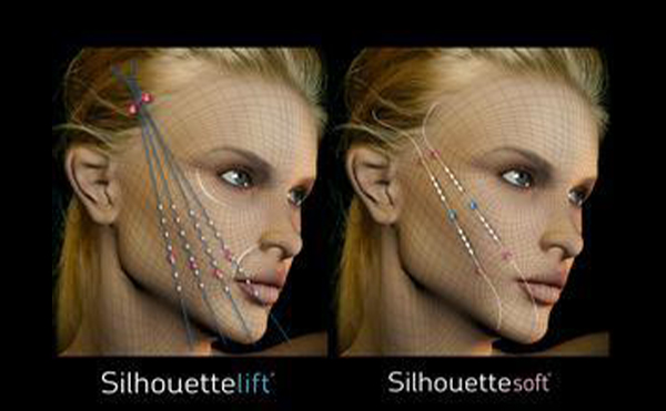 面部線雕后臉變形了是什么原因?還能恢復嗎?