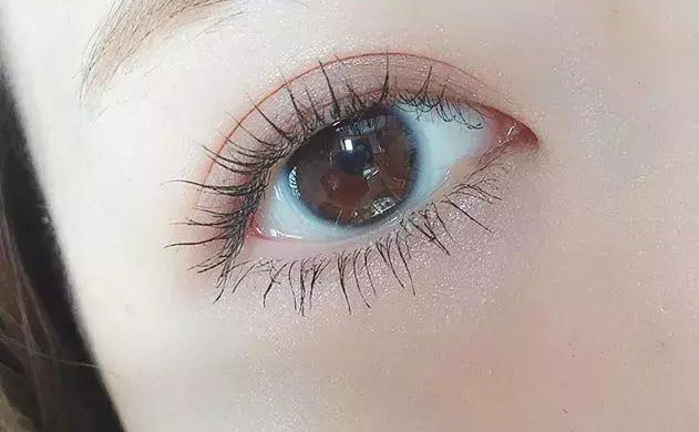 激光雙眼皮手術(shù)多少錢？激光雙眼皮手術(shù)需要多久恢復時間？