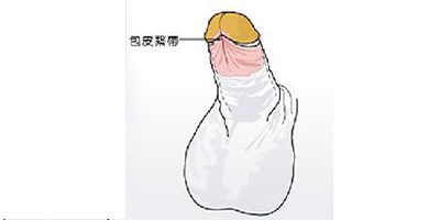 切包皮術(shù)后