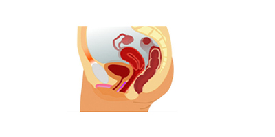 G點(diǎn)注射術(shù)前