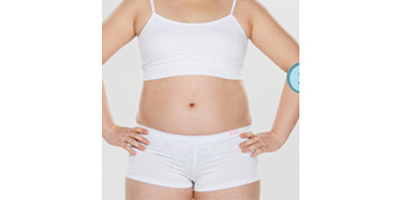 射頻溶脂瘦腰部術(shù)前