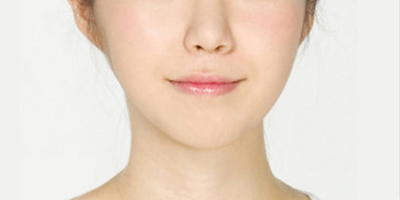 面部不對稱矯正術(shù)后