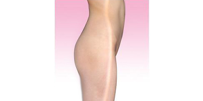 自體脂肪豐臀術(shù)后