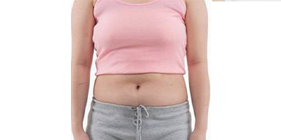 隔空溶脂瘦腹部術(shù)前