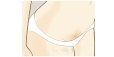 比基尼線脫毛術后