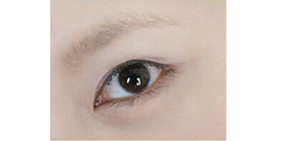 種植眉毛術(shù)前