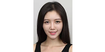 玻尿酸豐蘋果肌術后