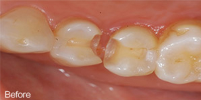 口腔檢查術(shù)前
