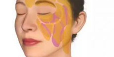 自體脂肪存儲術(shù)前