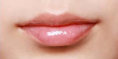半永久紋唇術(shù)后